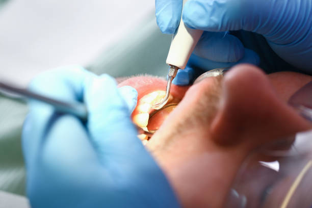 Best Orthodontic Emergency Dentist in Boone, NC